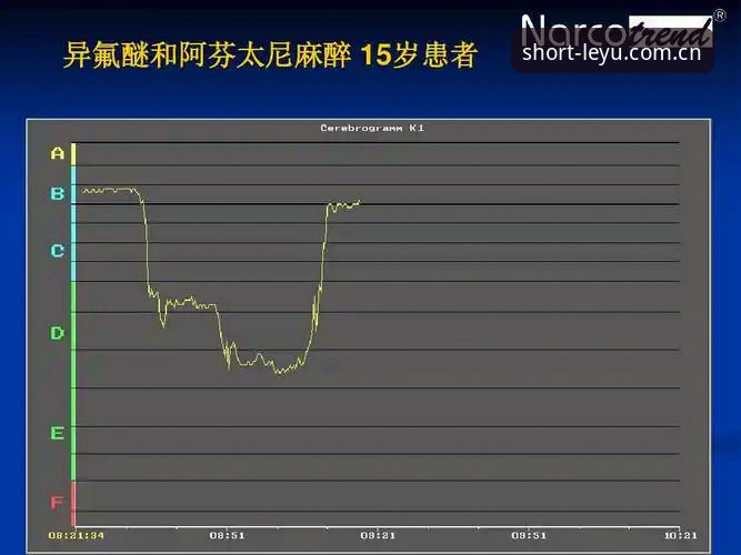 乐鱼赛事即时赔付率监测安全性深度分析
